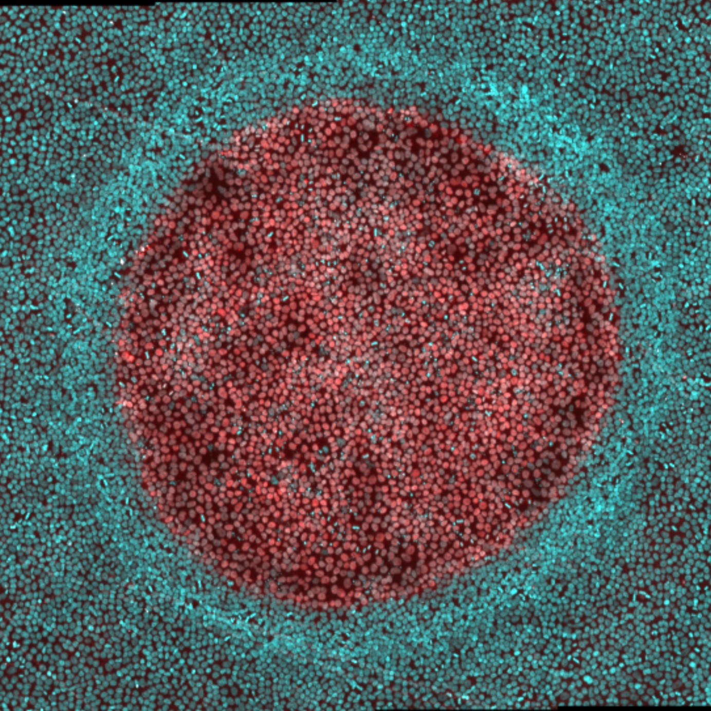 Contrôle spatio-temporel de haute précision du patterning tissulaire. Cyan : Noyaux de cellules souches embryoniares humaines. La zone centrale de tissu est stimulée par BMP4 (pSMAD1+, rouge)