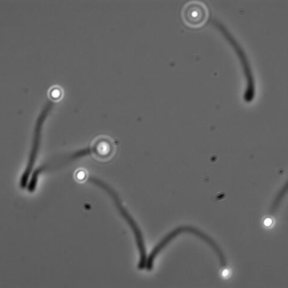 Image de microscopie optique montrant des billes de 0,5 µm (micromètre) de diamètre propulsées par l’assemblage de l’actine à leur surface. 