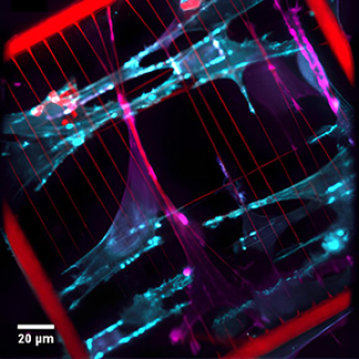 Timelapse de plusieurs cellules HUVEC Lifeact-GFP se propageant et exerçant des forces de traction sur des fibres photopolymérisées hautement déformables à faible temps d'exposition (en haut) et sur des fibres photopolymérisées moins déformables à temps d'exposition élevé (en bas).