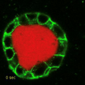 Mesure de pression hydrostatique par perçage local d’un cyste MDCK. En rouge la mucine, en vert les contours cellulaires ; le perçage local entraîne l’écoulement du liquide et permet la mesure de la pression hydrostatique. Épaisseur cellulaire 10mm.
