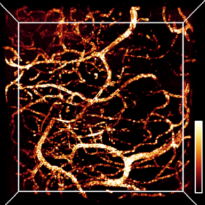 Imagerie 3D in vivo dans un cerveau de poisson zébré adulte.