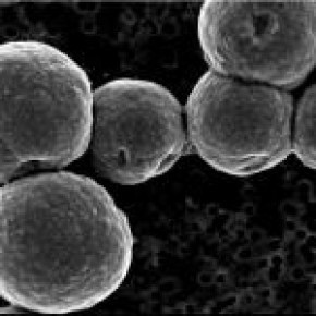 Groupe de cellules de l‘archée hyperthermophile Thermococcus kodakarensis,  pouvant se développer jusqu‘à 95°C. Ici, chaque cellule est une sphère de diamètre proche de 1 micron. Image microscopie à balayage électrons secondaires.
